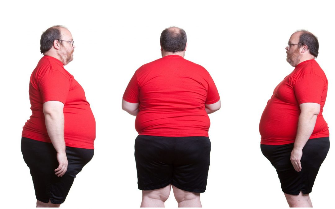 Obesity Epidemic: We All Should Be Concerned